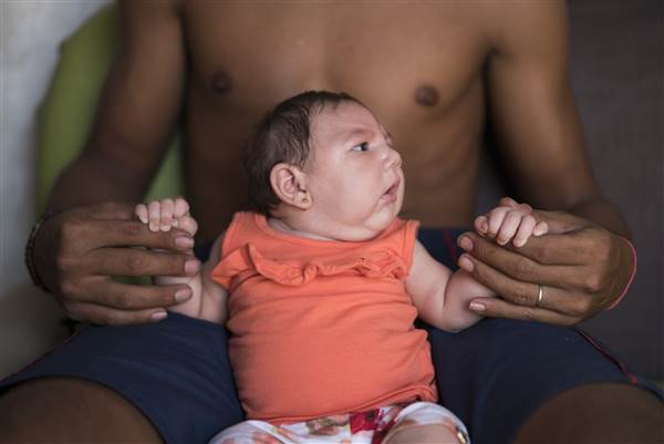 In this Dec. 23, 2015 photo, Dejailson Arruda holds his daughter Luiza at their house in Santa Cruz do Capibaribe, Pernambuco state, Brazil. Luiza was born in October with a rare condition, known as microcephaly. Luizas mother Angelica Pereira was infected with the Zika virus after a mosquito bite. Brazilian health authorities are convinced that Luizas condition is related to the Zika virus that infected her mother during pregnancy. (Felipe Dana/AP Images)