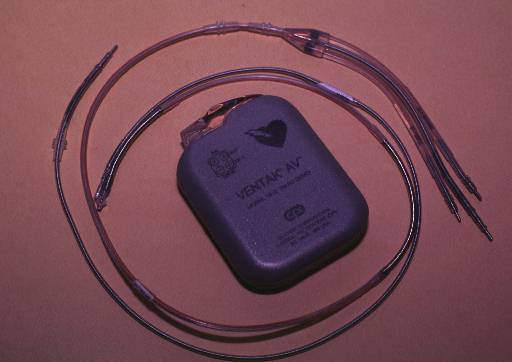 About the size of a personal pager, the Guidant/CPI Ventak implantable defibrillator is shown in Springfield, Mo., Thursday, July 24, 1997. It combines a pacemaker and defibrillator into a sophisticated computer and is implanted under the skin. The device received FDA approval on Monday, July 21, 1997.  (AP Photo/John S. Stewart)